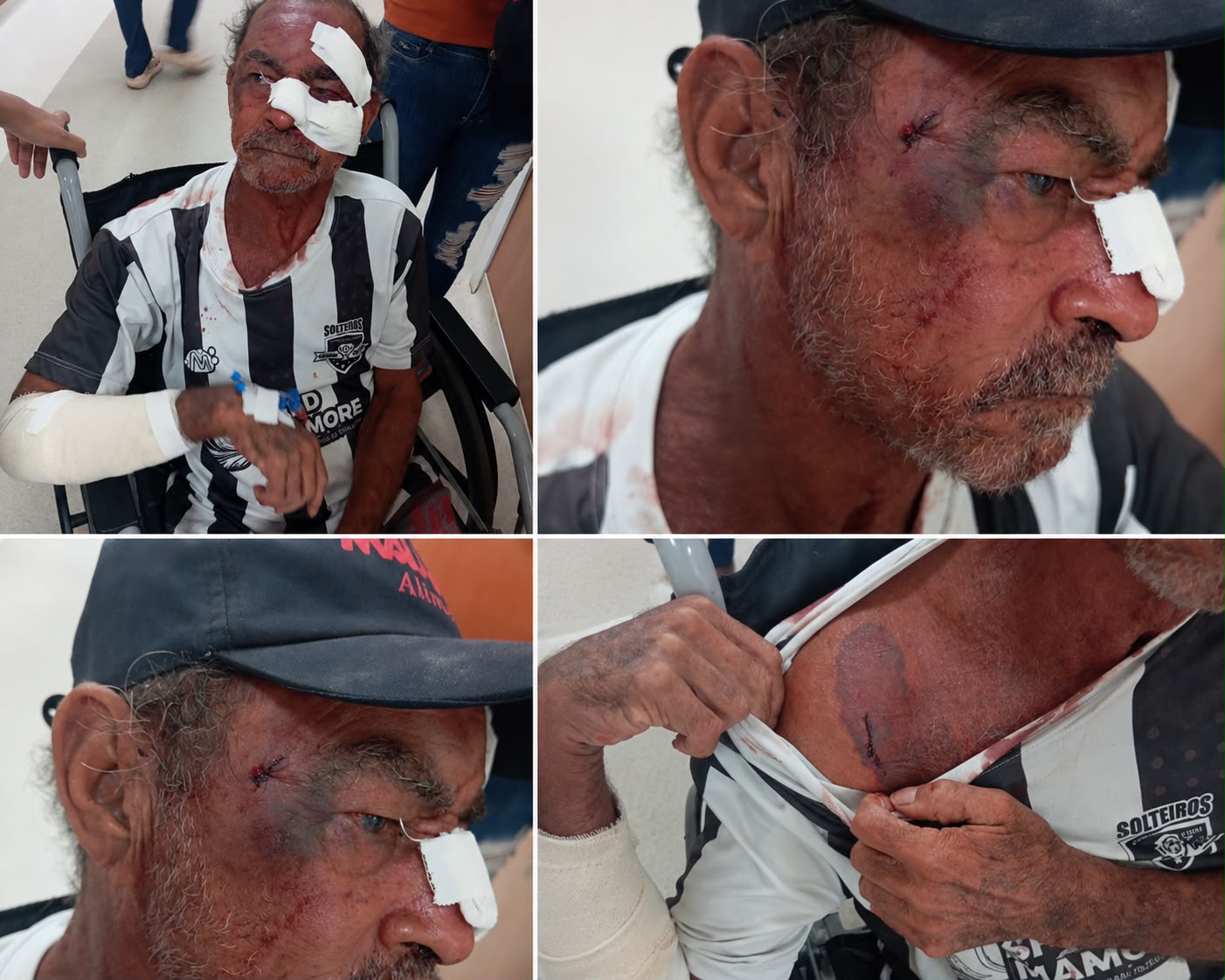 Gari de 66 anos trabalha na Praça Mãe Jonsina, em Ibotirama, onde foi agredido durante a madrugada.