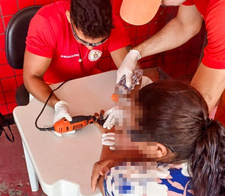Bombeiros militares do 17º BBM durante atendimento para retirada de anel de dedo inchado de uma senhora no oeste da Bahia.